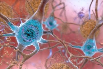 amyloid beta plaques|A gene guiding brain cell growth may regulate Alzheimer’s plaque .
